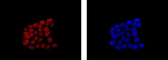 Sox9 Antibody Epr12755 50 Bsa And Azide Free Ab250751  Immunocytochemistry Immunofluorescence Img40317