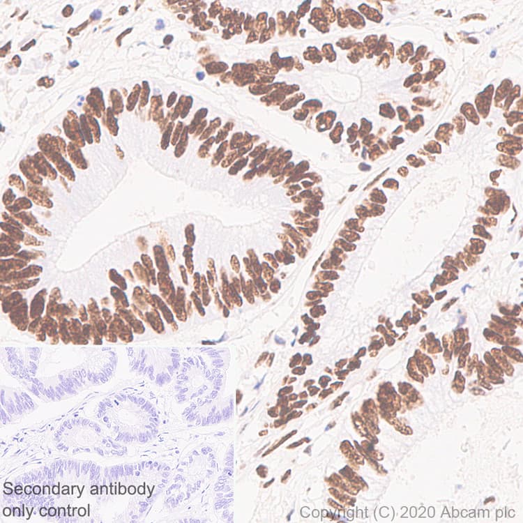 Anti-Human Nucleoli antibody [NM95] - Nucleolar Marker(AB190710)