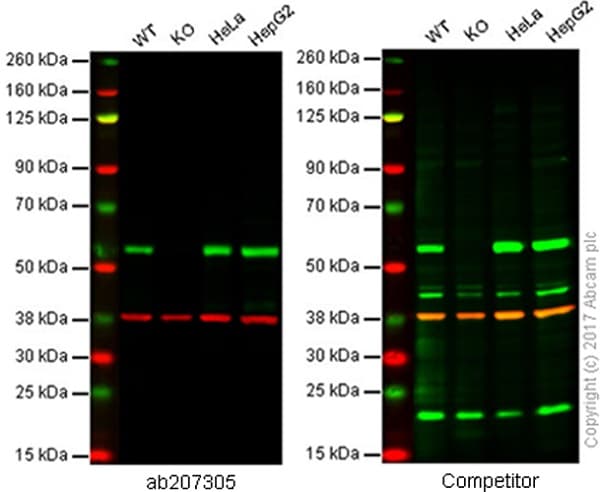Sqstm1 P62 Antibody Epr18351 Autophagosome Marker Ab207305  Western Blot Img19439