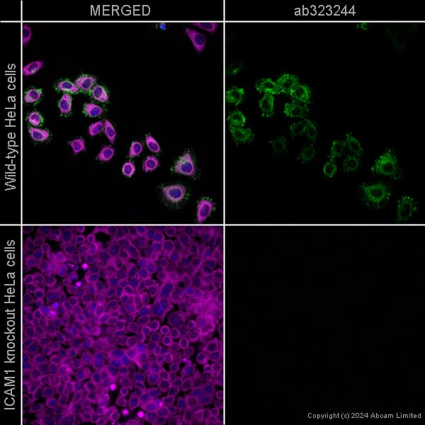 Alexa Fluor 594 Alpha Tubulin Antibody Ep1332y Microtubule Marker Ab202272  Immunocytochemistry Immunofluorescence Img440853