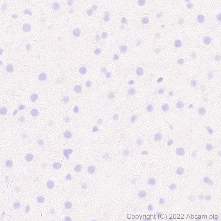 Anti-Nav1.8/SCN10A antibody [EPR25132-222](AB307817)