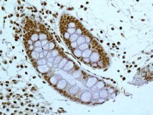 Anti-SF2 antibody [EPR8240](AB133689)