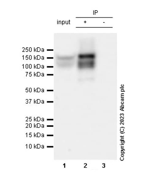 Trkc Antibody Epr22959 404 Ab313761  Immunoprecipitation Img419010