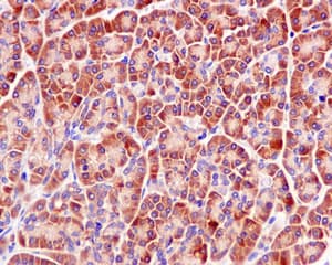 Rpl30 Antibody Epr11624 Bsa And Azide Free Ab249601  Immunohistochemistry Formalin Pfa Fixed Paraffin Embedded Sections Img41016