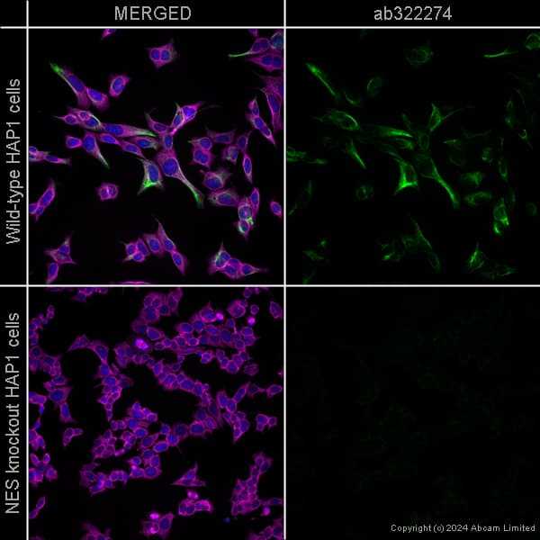 Anti-Nestin antibody [SP103] – Mouse IgG1 (Chimeric)(AB322274)