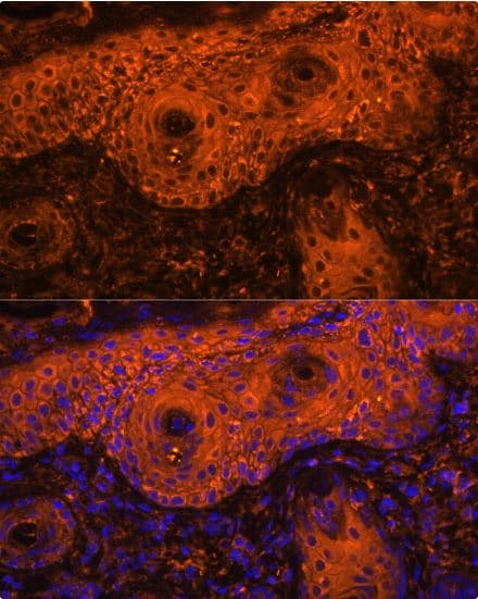 Anti-Tyrosinase antibody(AB180753)