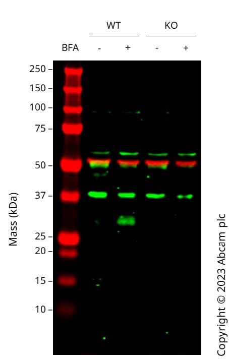 Anti-CD63 antibody [EPR5702] - Late Endosome Marker(AB134045)