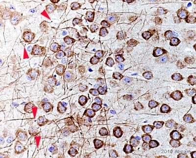 Anti-FMRP antibody(AB17722)