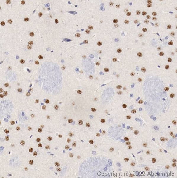Anti-FOXP1 antibody(AB16645)