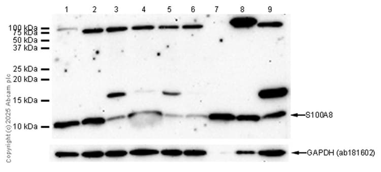 Anti-S100A8 antibody [EPR3554] - Low endotoxin, Azide free(AB219370)