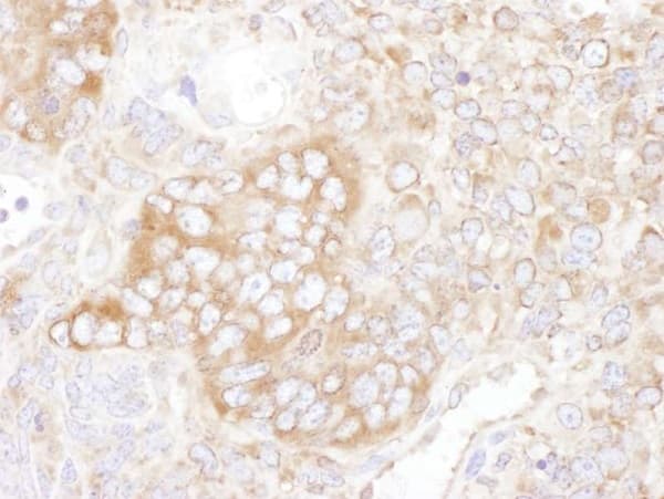 Anti-YB1 antibody(AB225706)