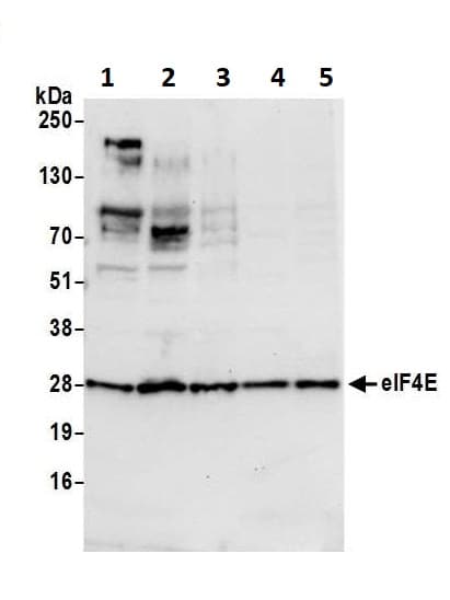 Eif4e Antibody Ab72116  Western Blot Img51034
