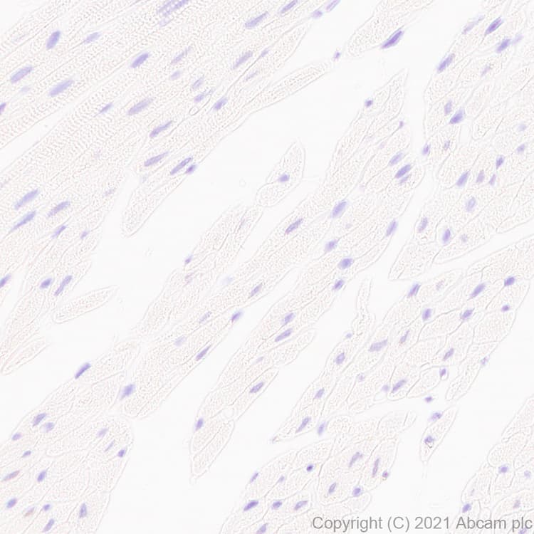 Scn1a Antibody Epr22326 112 Ab222091  Immunohistochemistry Formalin Pfa Fixed Paraffin Embedded Sections Img33146