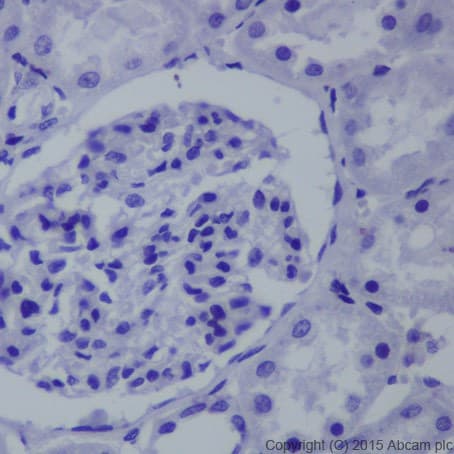 Anti-Brachyury / Bry antibody [EPR18113](AB209665)