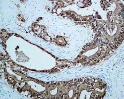 Anti-S100P antibody [EPR6142](AB124743)