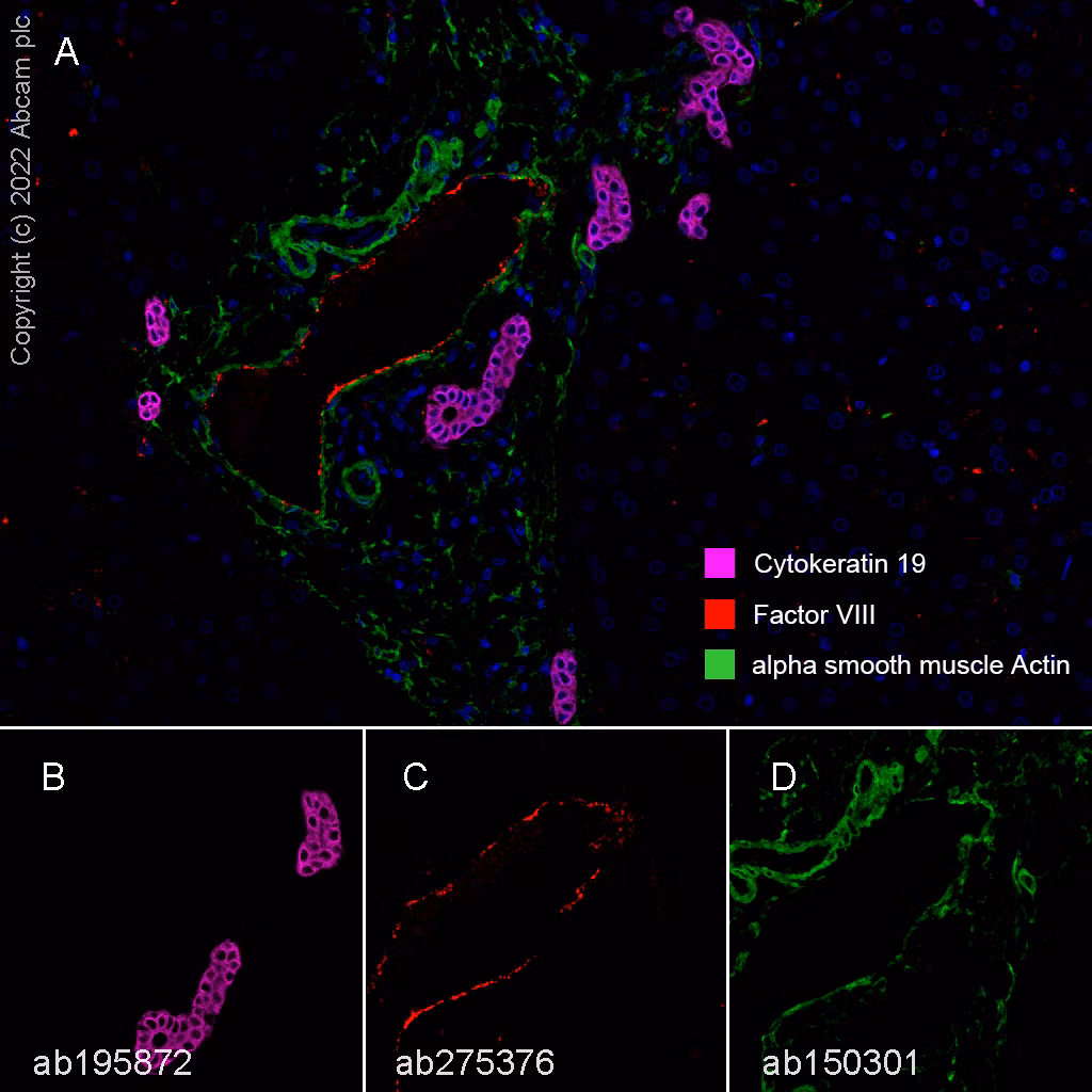 Cytokeratin 19 Antibody Ep1580y Cytoskeleton Marker Ab52625 Multiplex Immunohistochemistry Img409420