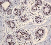 Chd3 Antibody Epncir110a Bsa And Azide Free Ab240942  Immunohistochemistry Formalin Pfa Fixed Paraffin Embedded Sections Img115704