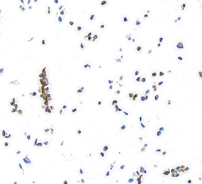Pdgfr Alpha Antibody Blr128h Bsa Free Ab314105  Immunocytochemistry Img420680