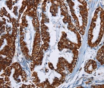 Maff Antibody Ab198249  Immunohistochemistry Formalin Pfa Fixed Paraffin Embedded Sections Img28893