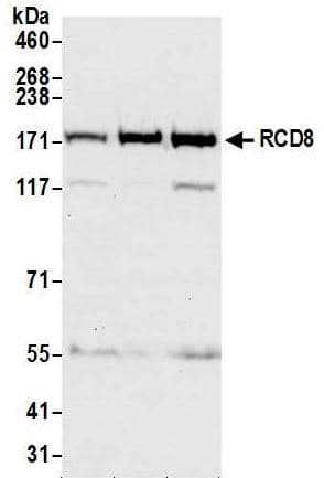 Edc4 Antibody Ab72408  Western Blot Img175813
