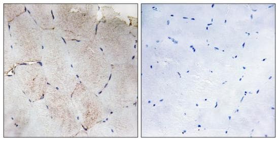 Col12a1 Antibody Ab196619  Immunohistochemistry Formalin Pfa Fixed Paraffin Embedded Sections Img111826