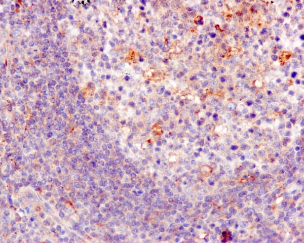 Kbtbd11 Antibody Epr100562b Bsa And Azide Free Ab249501  Immunohistochemistry Formalin Pfa Fixed Paraffin Embedded Sections Img78865
