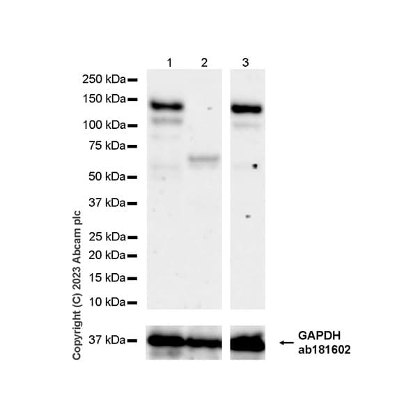Tacc3 Antibody Epr7756 Bsa And Azide Free Ab224525  Western Blot Img435942