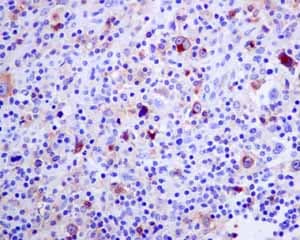 Il 2 Receptor Alpha Antibody Epr6452 Ab128955  Immunohistochemistry Formalin Pfa Fixed Paraffin Embedded Sections Img128493