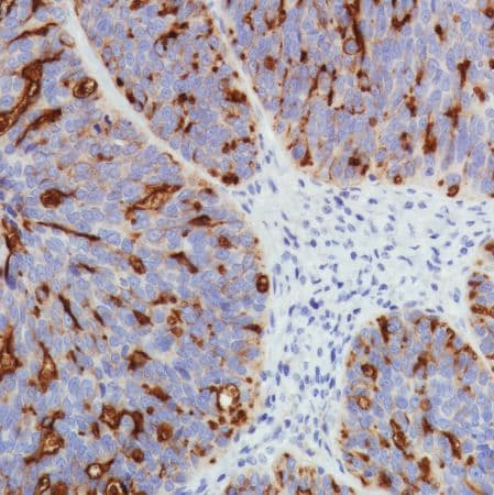 Anti-SLC34A2 antibody [SP322] - N-terminal(AB228474)
