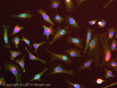 Anti-Transportin 1/MIP antibody [D45](AB10303)