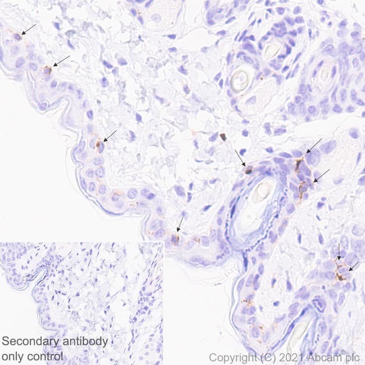 Anti-Langerin antibody [EPR24685-12](AB283686)