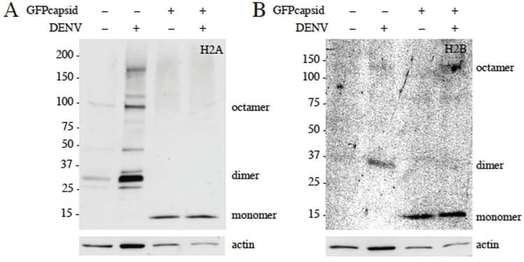Anti-Histone H2A antibody - ChIP Grade(AB18255)