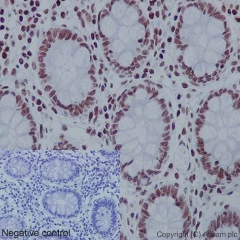 Anti-Histone H4 (acetyl K16) antibody [EPR1004] - BSA and Azide free(AB194352)
