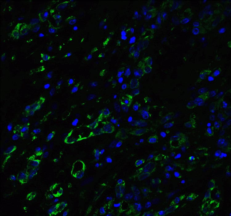 Anti-ACE2 antibody(AB15348)