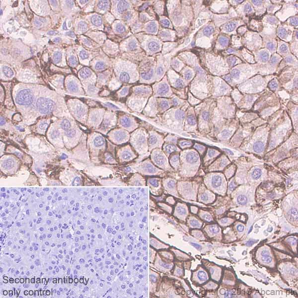 Anti-Glucose Transporter GLUT2 antibody [EPR22946-74](AB234440)