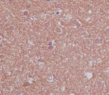 Nce2 Ube2f Antibody Epr12932 Bsa And Azide Free Ab240291  Immunohistochemistry Formalin Pfa Fixed Paraffin Embed 2TIEJvo29M
