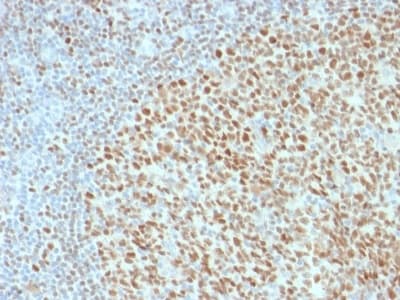 Anti-Oct-2 antibody [OCT2/2136](AB236534)