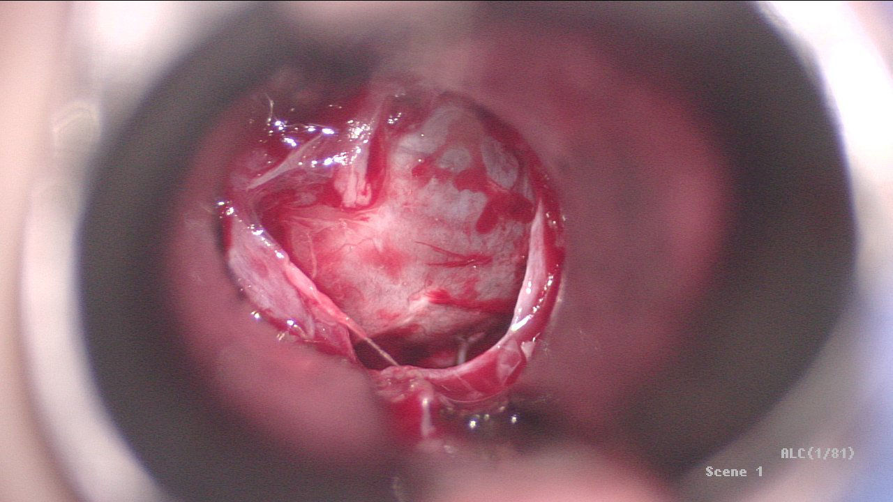 HD C100 Second Generation HD Medical Camera