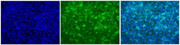 Anti-NF-kB p65 antibody [E379](AB32536)