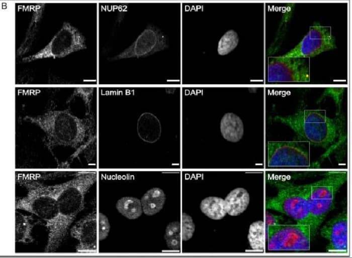 Anti-FMRP antibody(AB17722)
