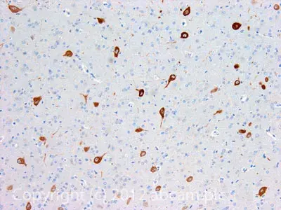 Anti-Muscarinic Acetylcholine Receptor M3/CHRM3 antibody(AB87199)