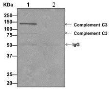 C3 C3a Antibody Epr29872abcb Ab171080  Immunoprecipitation Img116801