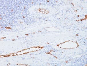 Von Willebrand Factor Antibody 3e2d10 Ab194405  Immunohistochemistry Formalin Pfa Fixed Paraffin Embedded Sections Img92837