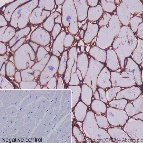 Anti-Collagen VI antibody [EPR17072](AB182744)