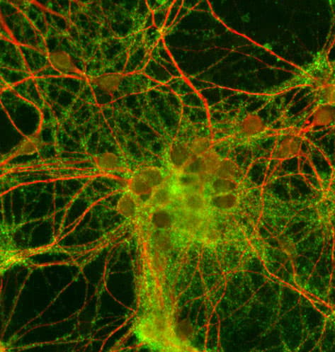 Synaptophysin Antibody Synaptic Marker Ab32594  Immunocytochemistry Immunofluorescence Img114408