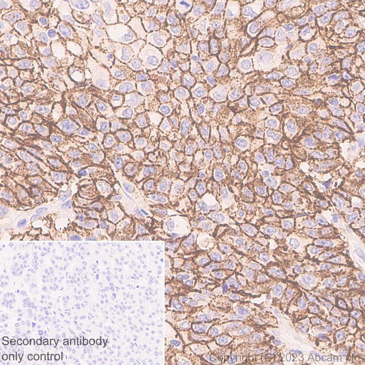 Anti-Claudin18 antibody [43-14A](AB314690)