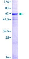 Recombinant Human CD20 protein(AB158047)