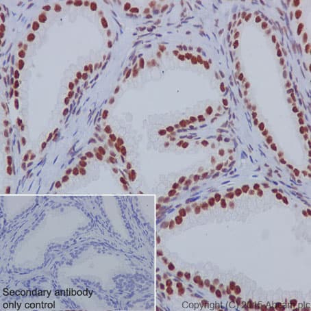 Anti-nmt55 / p54nrb antibody [EPR5270](AB133574)
