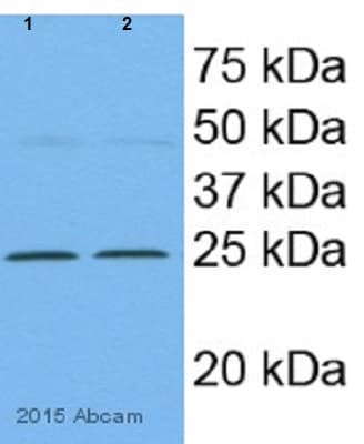 Anti-SOD2/MnSOD antibody(AB13533)