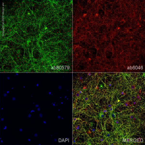 Anti-Tau antibody [TAU-5] - BSA and Azide free(AB80579)